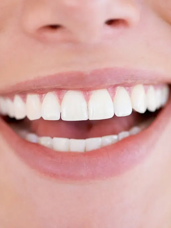 Denti 2